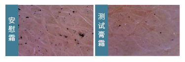 DS-CERAMIDE AP(圖1)